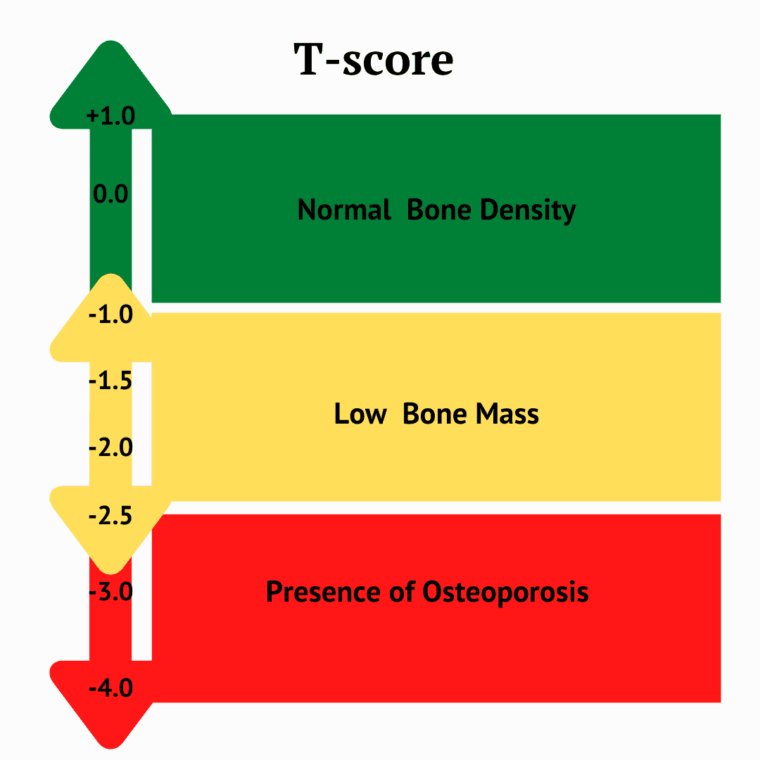 Ultrasəs Sümük Densitometri 3