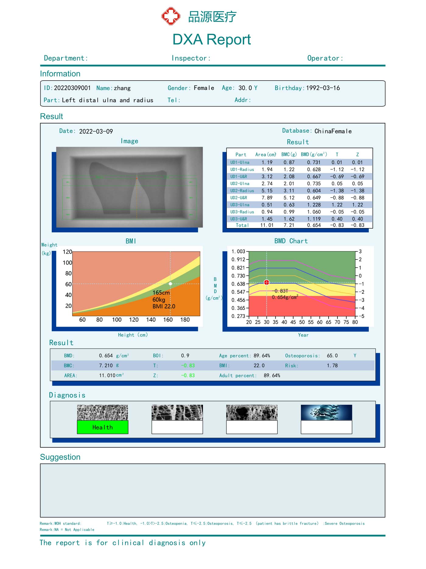 DXA-800E-(2)