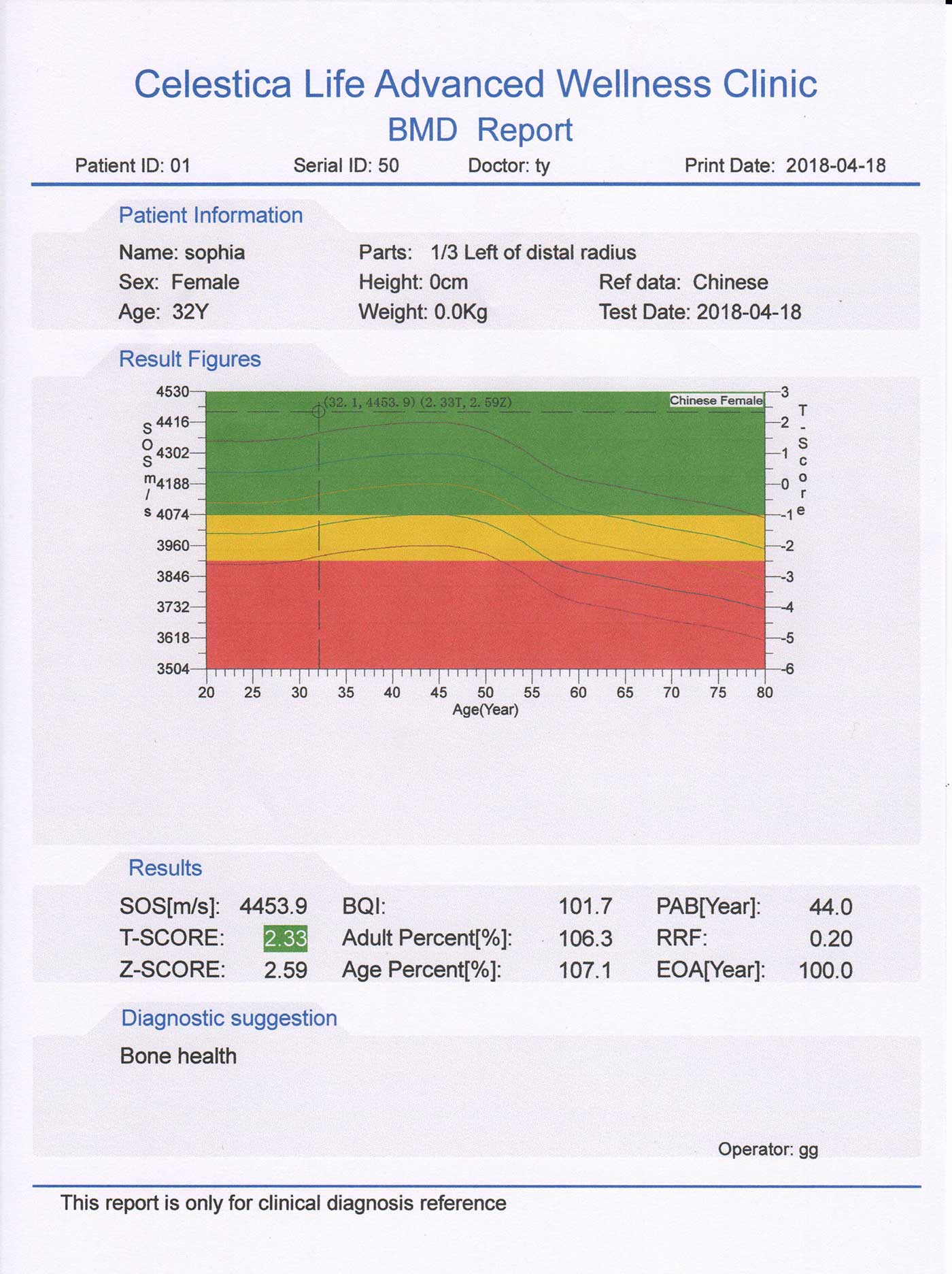 informe