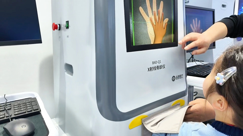 X-ray bone age analysers