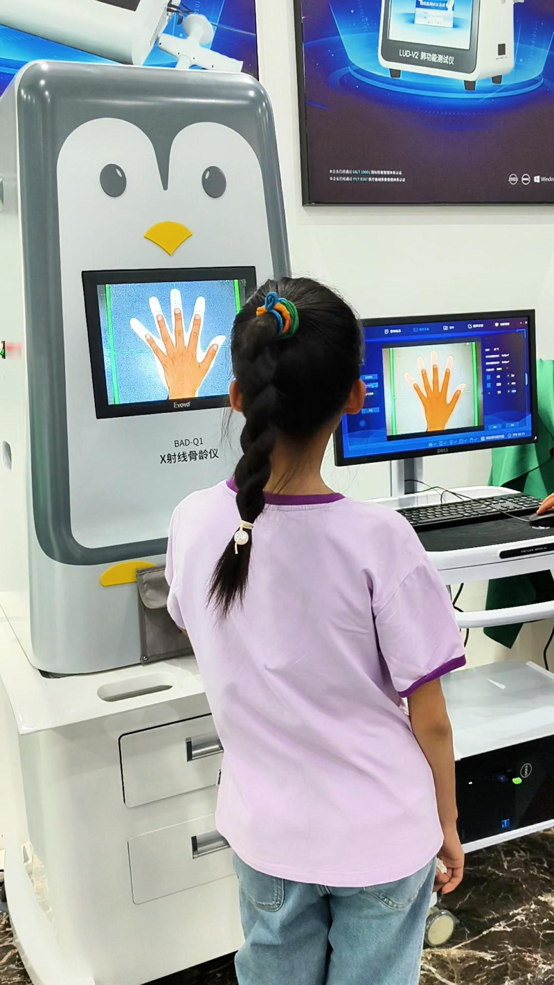  X-ray bone age analysers